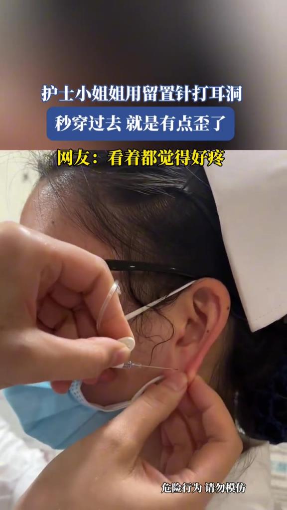 护士小姐姐用留置针打耳洞,秒穿过去,就是有点歪了!!