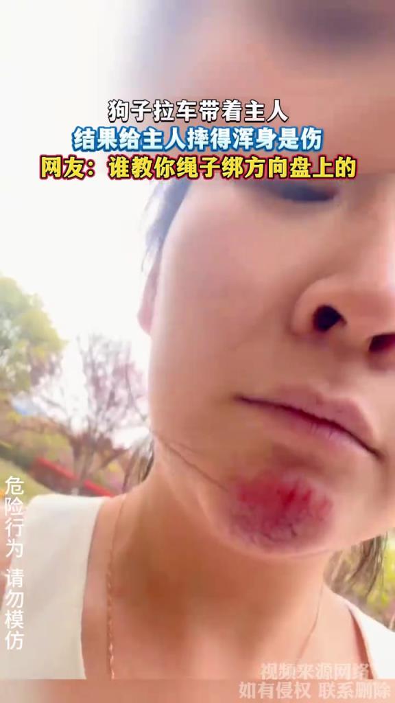 狗子拉车带着主人 结果给主人摔得浑身是伤