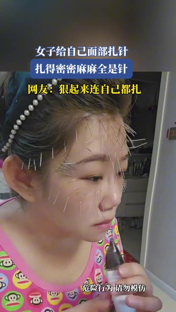 女子给自己面部扎针,扎得密密麻麻全是针!