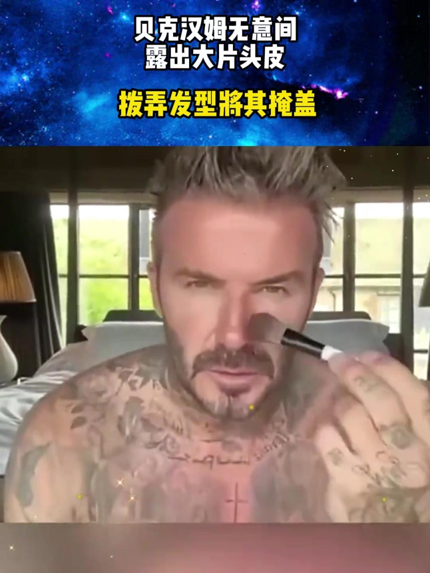 贝克汉姆无意间露出大片头皮，谢顶是男人的归宿吗！