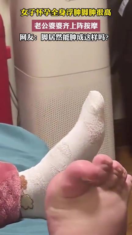 女子怀孕全身浮肿脚肿很高，老公婆婆齐上阵按摩