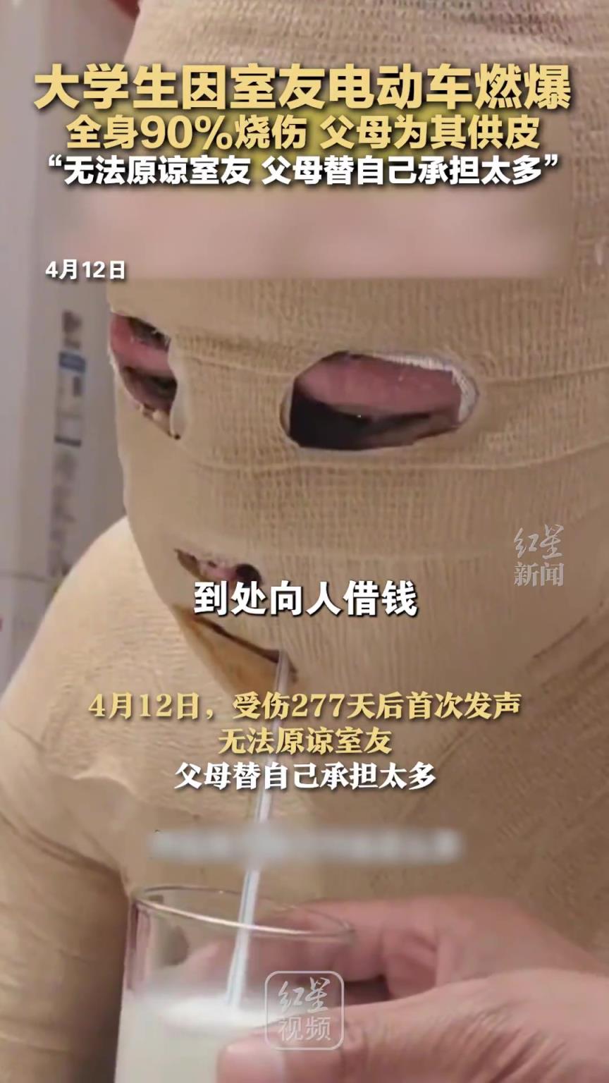 电瓶燃爆烧伤男生称无法原谅室友，“父母替自己承担太多”