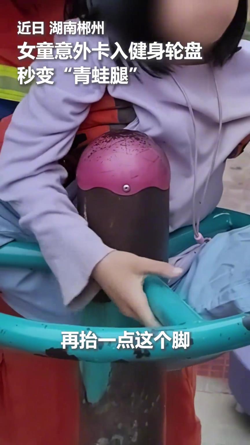 女孩意外滑入健身輪盤，瞬間卡成“青蛙腿”