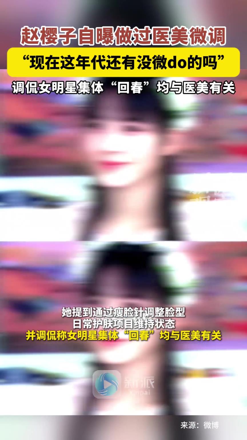 趙櫻子自曝微do：現(xiàn)在這年代還有沒微do的嗎