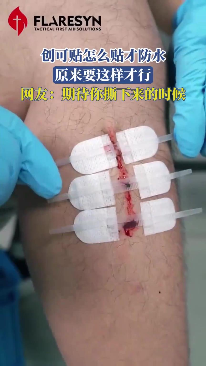 創(chuàng)可貼怎么貼才防水，原來要這樣才行