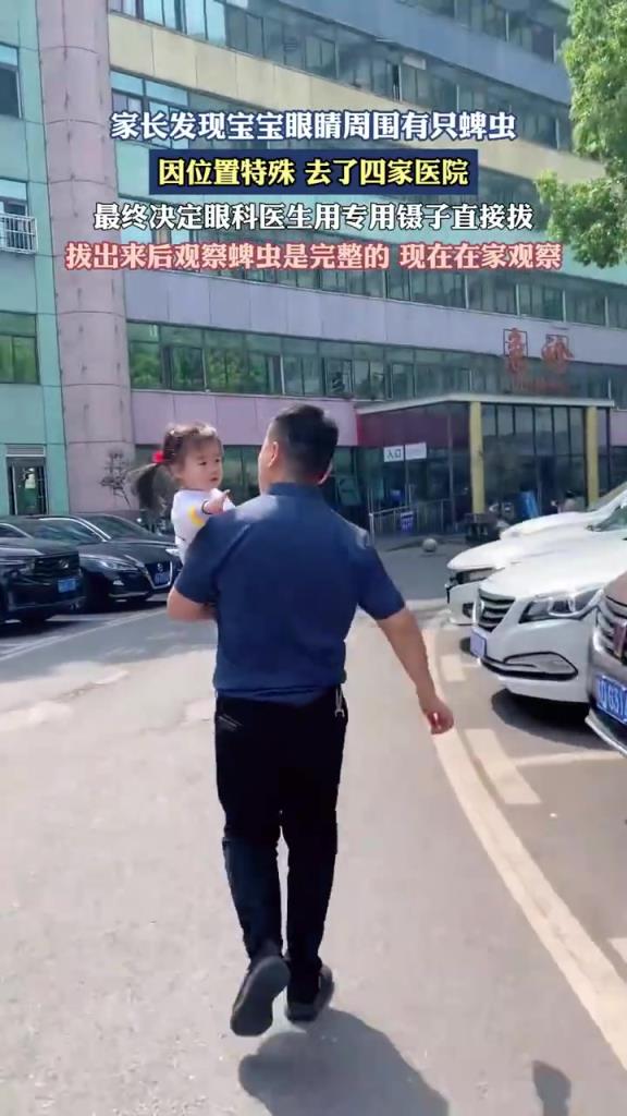 寶寶眼周卡蜱蟲跑四家醫院處理