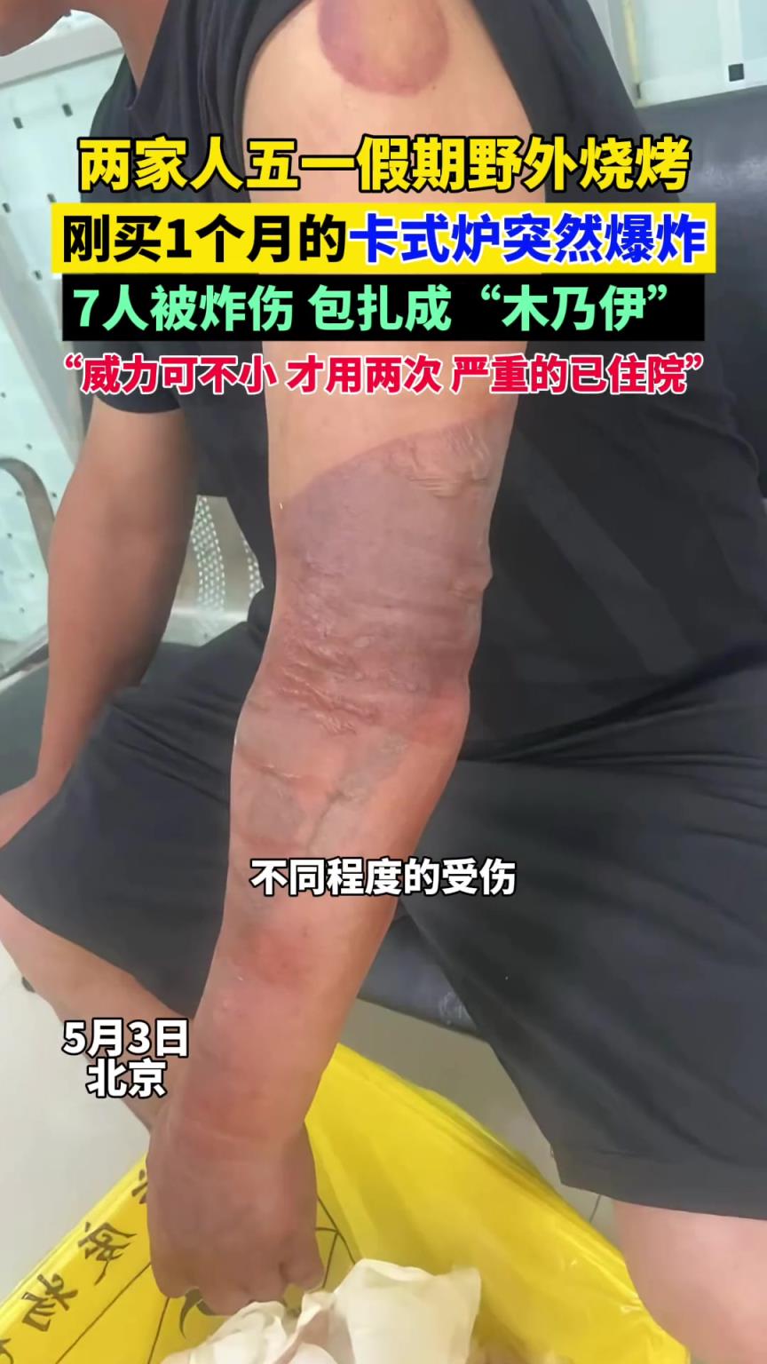 兩家人五一假期野外燒烤，剛買1個月的卡式爐突然爆炸