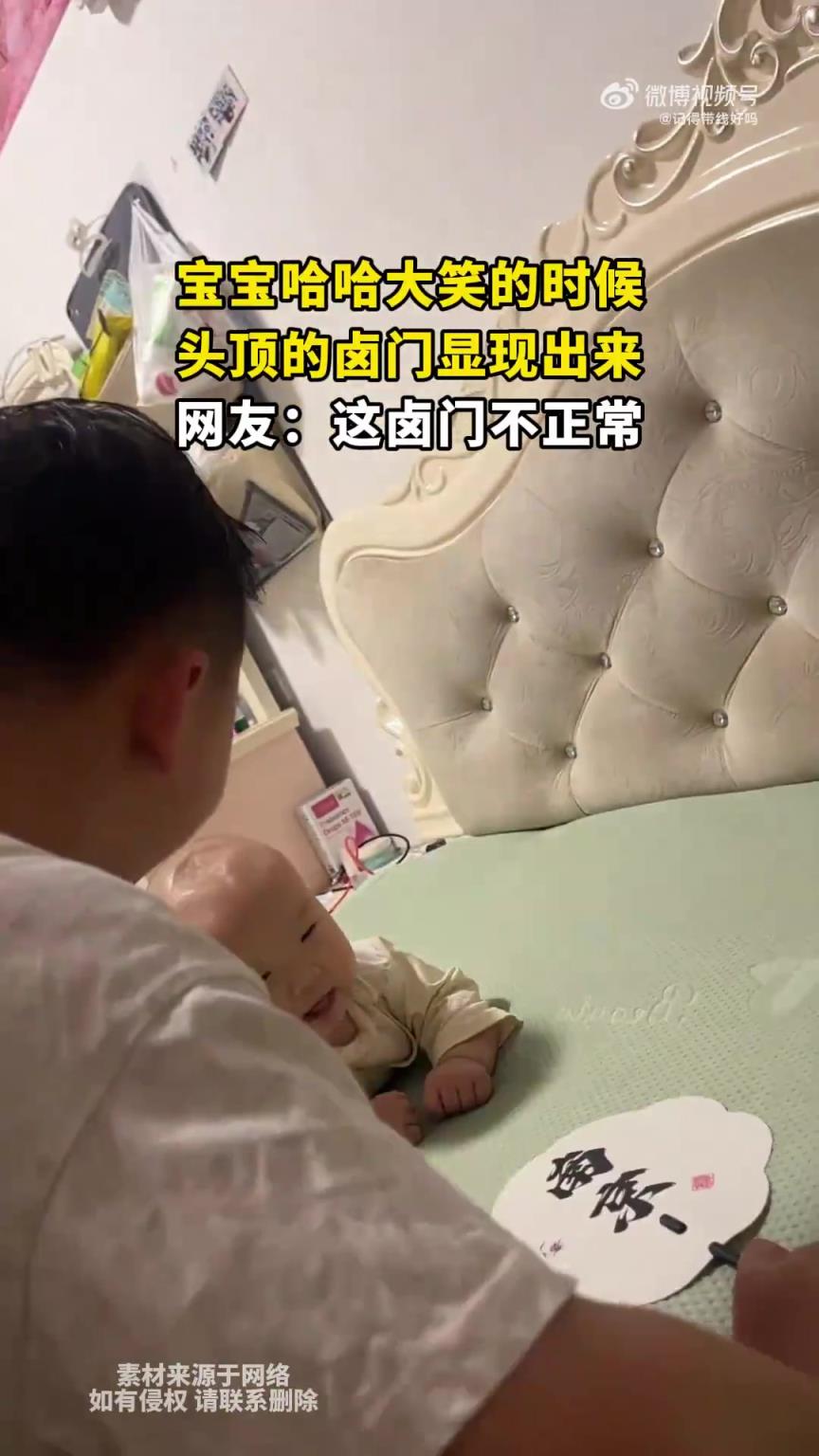 宝宝哈哈大笑的时候，头顶的卤门显现出来，网友：这卤门不正常