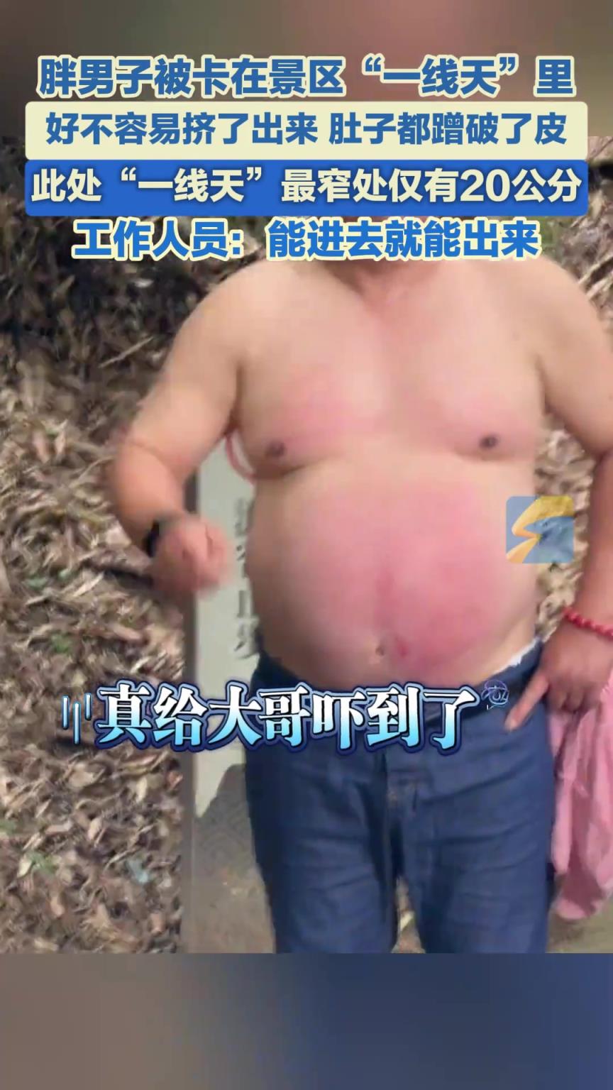 胖男子被卡在景区“一线天”里，好不容易挤了出来肚子都蹭破了皮