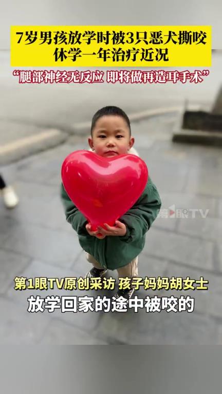 7歲男孩被3只惡犬撕咬一年后近況?。? title=