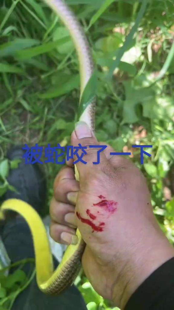 被蛇咬了還有心思拍視頻嗎？