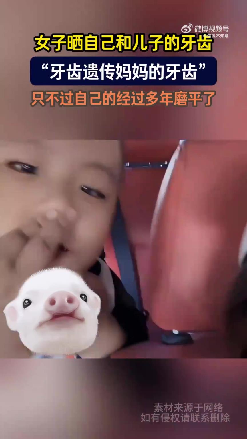 女子晒与儿子牙齿，感叹“牙齿遗传妈妈”