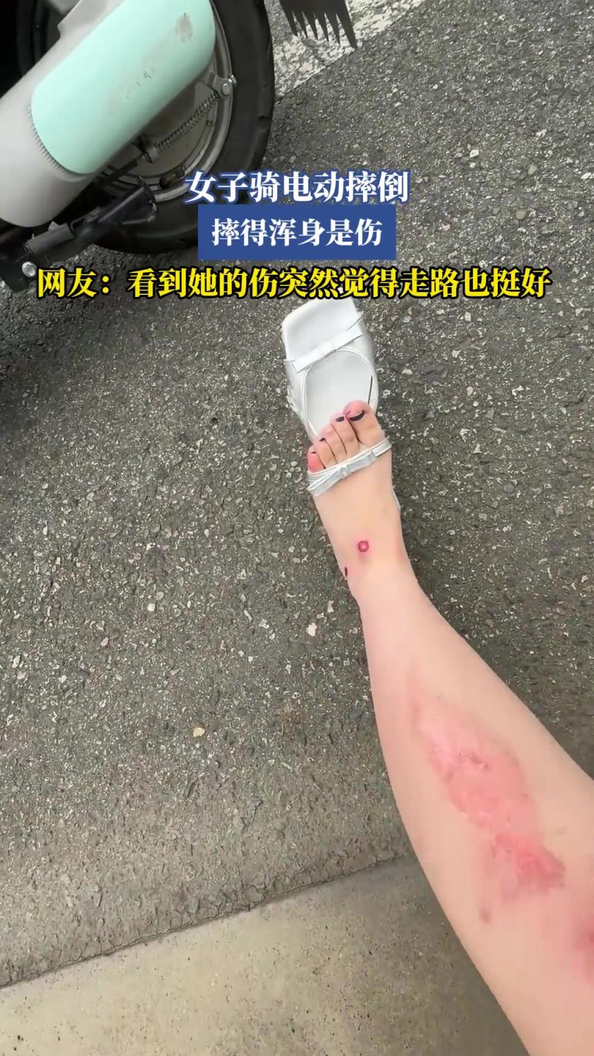 女子骑电动摔倒，摔得浑身是伤，看到她的伤突然觉得走路也挺好