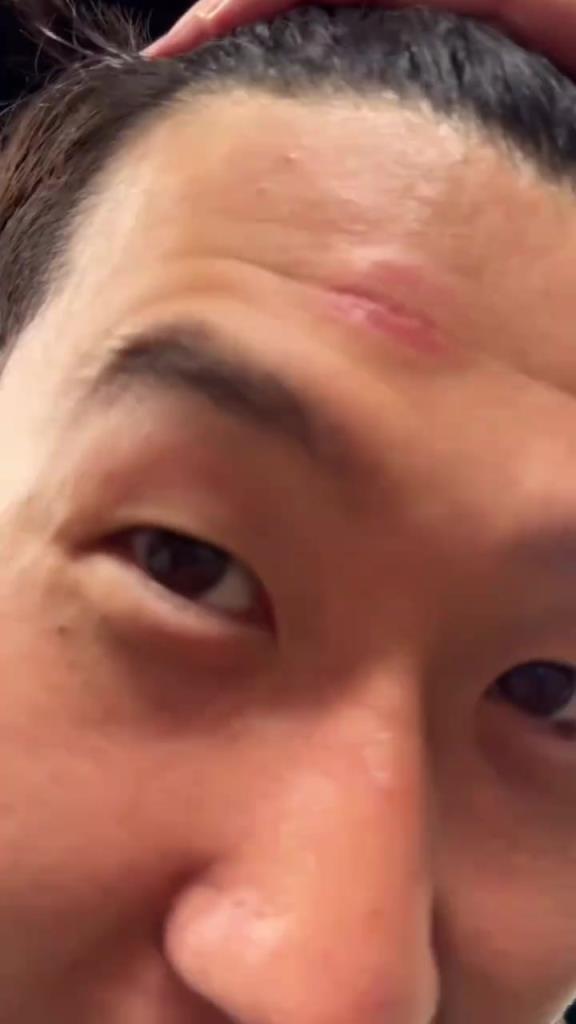 腦門腫了！孫興慜被人推撞到了獎杯，但孫哥高興得合不攏嘴