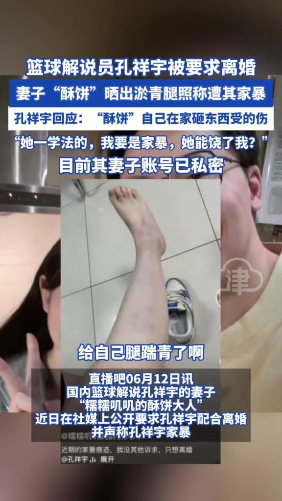 籃球解說員孔祥宇妻子“酥餅”曬出淤青腿照 稱遭其家暴